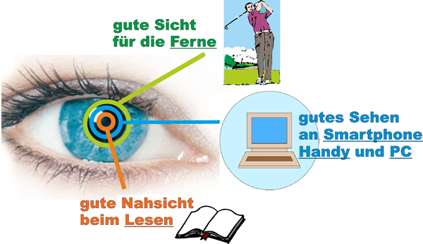 Multifokal-Kontaktlinsen für Nah- und Fernsicht - jetzt bei GB Optiker Darmstadt.